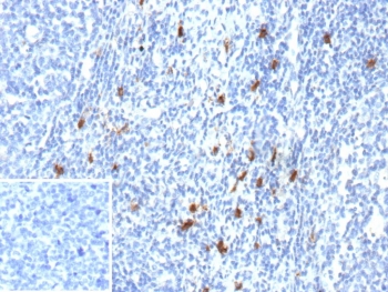 Immunohistochemistry analysis of CD83 molecule Antibody in human tonsil tissue. FFPE human tonsil demonstrates distinct HRP-DAB brown staining in scattered dendritic-shaped cells within the lymphoid tissue, consistent with CD83-positive mature dendritic cells, while the majority of surrounding lymphocytes remain negative. The inset image, using PBS in place of primary antibody as a secondary-only negative control, shows no specific staining. Antigen retrieval was performed by heating tissue sections in 10mM Tris with 1mM EDTA, pH 9.0, at 95oC for 45 minutes followed by cooling at room temperature for 20 minutes prior to incubation with CD83 antibody (clone r1H4b).