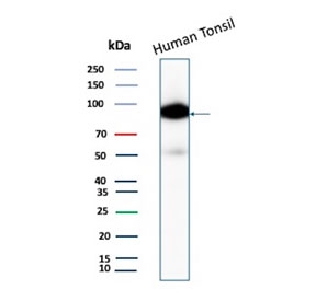 CD19 Antibody Human Tonsil WB. Western blot analysis of human tonsil tissue lysate using recombinant CD19 Antibody / B Cell Marker Antibody (clone CD19/4260R). A specific band is detected between approximately 60â100 kDa, consistent with the expected molecular weight range of glycosylated CD19 protein. Detection in human lymphoid tissue supports CD19 expression as a B cell surface marker. These results support the use of CD19 Antibody / B Cell Marker Antibody, a Protein Microarray Validated recombinant monoclonal antibody, for studying B lymphocyte biology, immune cell signaling and hematopoietic research pathways.