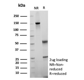 SDS-PAGE analysis of purified, BSA-free recombinant CD34 antibody (clone rICO-115) as confirmation of integrity and purity.