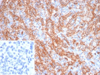 Platelet Glycoprotein 4 Antibody Human Spleen IHC. Immunohistochemical staining of FFPE human spleen demonstrates CD36 expression using Platelet Glycoprotein 4 Antibody clone CD36/7216. Platelet Glycoprotein 4, also known as CD36 and Lipid Uptake Protein, is a class B scavenger receptor involved in fatty acid transport, oxidized lipoprotein uptake, and immune regulation. Prominent membranous staining is observed in splenic macrophages and sinusoidal lining cells, consistent with the known distribution of CD36, while most lymphoid cells exhibit minimal reactivity. The inset shows PBS substituted for the primary antibody as a secondary only negative control. Heat induced epitope retrieval was performed in pH 9 10 mM Tris buffer containing 1 mM EDTA at 95 degrees Celsius for 20 minutes followed by cooling prior to staining. These results support the utility of Platelet Glycoprotein 4 Antibody for studies of lipid metabolism, scavenger receptor biology, inflammation, and immune responses.