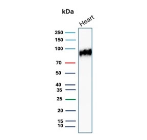 Platelet Glycoprotein 4 Antibody Human Heart WB. Western blot analysis of human heart tissue lysate demonstrates CD36 expression using Platelet Glycoprotein 4 Antibody clone CD36/7216. Platelet Glycoprotein 4, also known as CD36 and Lipid Uptake Protein, is a multifunctional scavenger receptor that mediates long chain fatty acid uptake and contributes to cardiac energy metabolism. A prominent band is detected at approximately 90 kDa, consistent with the heavily glycosylated form of CD36. The apparent molecular weight of CD36 is known to vary from approximately 53 to 88 kDa depending on the degree of glycosylation. These results support the utility of Platelet Glycoprotein 4 Antibody for studies of lipid transport, cardiovascular biology, metabolic regulation, and scavenger receptor function.