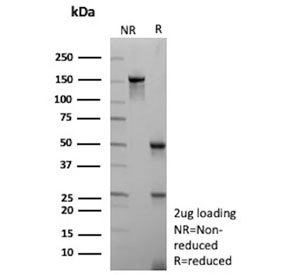 SDS-PAGE analysis of purified, BSA-free ADP-ribosyl cyclase 1 antibody (clone CD38/9332) as confirmation of integrity and purity.