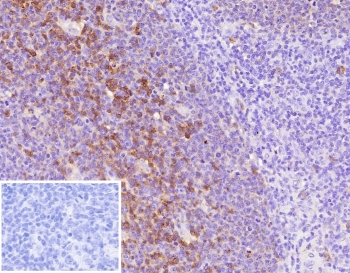 ADPRC1 Antibody human tonsil tissue IHC. Immunohistochemistry analysis of CD38 expression in FFPE human tonsil tissue using ADPRC1 antibody clone CD38/9333. Strong membranous and cytoplasmic HRP-DAB brown staining highlights plasma cells and activated lymphocytes within interfollicular regions and surrounding germinal centers, consistent with ADPRC1 gene expression across immune cell populations. The staining pattern demonstrates variable signal intensity reflecting differences in expression level among immune cell subsets, with clear contrast against predominantly negative background lymphocytes. Inset: PBS was used in place of the primary antibody as a secondary antibody negative control. HIER was performed by boiling tissue sections in pH 9 10 mM Tris with 1 mM EDTA for 20 minutes followed by cooling prior to antibody incubation.