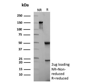 SDS-PAGE analysis of purified, BSA-free ADPRC1 antibody (clone CD38/9333) as confirmation of integrity and purity.