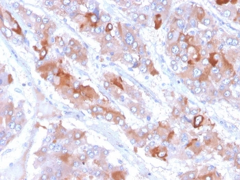 IHC staining of FFPE human adrenal gland tissue with Clusterin antibody (clone CLU/6692). HIER: boil tissue sections in pH 9 10mM Tris with 1mM EDTA for 20 min and allow to cool before testing.