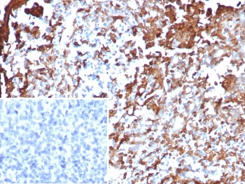 IHC staining of FFPE human tonsil tissue with ANXA1 antibody (clone rANXA1/9145). HIER: boil tissue sections in pH 9 10mM Tris with 1mM EDTA for 20 min and allow to cool before testing.