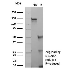 SDS-PAGE analysis of purified, BSA-free recombinant ANO1 antibody (clone rDG1/8750) as confirmation of integrity and purity.