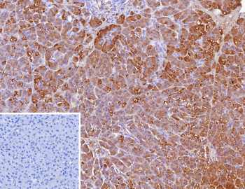 Immunohistochemistry analysis of CELA3A expression. CELA3A/Chymotrypsin like elastase 3A antibody (clone CELA3A/12553) staining was performed on formalin-fixed, paraffin-embedded human pancreas tissue, showing strong DAB-positive cytoplasmic staining in pancreatic acinar cells, with hematoxylin counterstaining. The inset shows a negative control processed in parallel using PBS in place of the primary antibody, demonstrating minimal background signal with secondary antibody only.