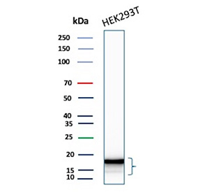 Western blot testing of human HEK293 cell lysate using CDKN2A/p16INK4a antibody (clone CDKN2A/13309R).