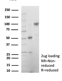 SDS-PAGE analysis of purified, BSA-free CDKN2A/p16INK4a antibody (clone CDKN2A/13309R) as confirmation of integrity and purity.