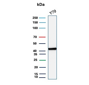 Western blot analysis of human Y79 cell lysate using CKB/Creatine kinase B-type antibody (clone CKBB/8295R). Predicted molecular weight ~43 kDa.