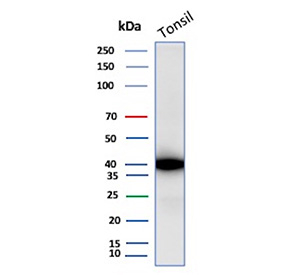 Apolipoprotein J Antibody Tonsil WB. Western blot analysis of human tonsil tissue lysate using recombinant Apolipoprotein J/ApoJ antibody (clone r7D1). Predicted molecular weight: 36-39 kDa (alpha subunit).
