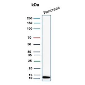 CLPS Antibody Human Pancreas WB. Western blot analysis of human pancreas lysate using CLPS antibody. The recombinant rabbit monoclonal antibody clone CLPS/12806R detects a band at approximately 12 kDa, consistent with the predicted molecular weight of Colipase / CLPS. Strong signal in pancreatic tissue aligns with its role as a digestive enzyme cofactor produced by acinar cells, while low background supports specific detection of this pancreatic enzyme marker.