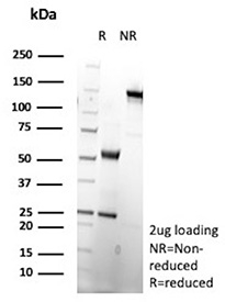 SDS-PAGE Analysis of purified recombinant OX2R/OX-2 receptor antibody (clone CD200R1/9919R). Confirmation of Purity and Integrity of Antibody.