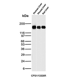 CPS1 Antibody Hepatocyte Marker WB. Western blot analysis of Carbamoyl Phosphate Synthetase 1 / CPS1 in human, mouse, and rat liver tissue lysates using hepatocyte specific antigen CPS1 antibody, clone CPS1/13326R. A band is detected at approximately 165 kDa across all species, consistent with the predicted molecular weight of CPS1 and supporting its use as a hepatocyte-associated marker in liver tissue.