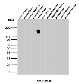 CPS1 Antibody Hepatocyte Specificity WB. Western blot analysis of Carbamoyl Phosphate Synthetase 1 / CPS1 across human tissue lysates including brain, heart, intestine, kidney, liver, lung, pancreas, skeletal muscle, skin, spleen, and stomach using hepatocyte specific antigen CPS1 antibody, clone CPS1/13326R. A prominent band is detected at approximately 165 kDa exclusively in the liver lysate, consistent with the predicted molecular weight of CPS1 and supporting its highly hepatocyte-enriched expression profile with minimal detection in non-hepatic tissues.