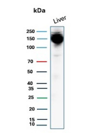 Western blot analysis of human liver tissue lysates using Hepatocyte specific antigen/CPS1 antibody (clone CPS1/13326R). Predicted molecular weight ~165 kDa.