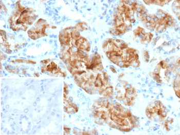 Immunohistochemistry analysis of CRYAB in human kidney tissue. Formalin-fixed, paraffin-embedded human kidney tissue was stained using recombinant CRYAB/Alpha-crystallin B chain antibody (clone rG2JF), showing cytoplasmic staining in renal tubular epithelial cells consistent with stress-associated CRYAB expression. Antigen retrieval was performed by heating tissue sections in 10 mM Tris with 1 mM EDTA, pH 9.0, at 95oC for 45 minutes, followed by cooling at room temperature for 20 minutes. Inset shows PBS substituted for the primary antibody as a secondary-only negative control.