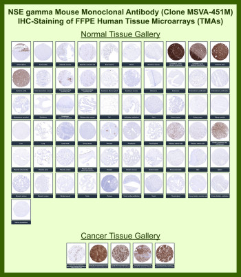 Gamma-enolase Antibody for IHC Tissue Microarray (TMA) Multi-Tissue Expression. Immunohistochemistry analysis of Gamma-enolase (ENO2) expression in FFPE human tissue microarray (TMA) sections using Gamma-enolase Antibody for IHC clone MSVA-451M demonstrates strong cytoplasmic HRP-DAB brown staining in neuronal tissues, including cerebellum and cerebral cortex, as well as in neuroendocrine cell populations, while most non-neural tissues remain largely negative. In cancer tissue microarrays, variable cytoplasmic staining is observed in tumors with neuroendocrine or neuronal differentiation, supporting its use as a neuroendocrine lineage marker in immunohistochemistry-based analysis. The clear contrast between ENO2-positive cells and surrounding negative tissues enhances interpretability across TMA cores. Observed staining patterns are consistent with reference datasets such as the Human Protein Atlas, and heat-induced epitope retrieval was performed prior to staining to ensure optimal antigen detection in FFPE sections.