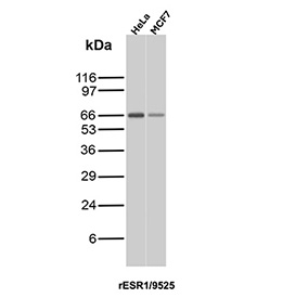 ESR1 Antibody Recombinant Mouse MAb WB. Western blot analysis of human HeLa and MCF7 cell lysates using recombinant ESR1/Estrogen receptor 1 antibody (clone rESR1/9525). Predicted molecular weight ~67 kDa.