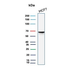 Western blot analysis of human MCF7 cell lysates using recombinant ESR1/Estrogen receptor 1 antibody recombinant mouse mAb rESR1/9525). Predicted molecular weight ~67 kDa.