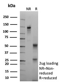 SDS-PAGE Analysis of purified recombinant ESR1/Estrogen receptor 1 antibody (clone rESR1/9525). Confirmation of Purity and Integrity of Antibody.