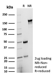 SDS-PAGE Analysis of purified ER beta/Estrogen receptor beta antibody (clone ESR2/9710). Confirmation of Purity and Integrity of Antibody.