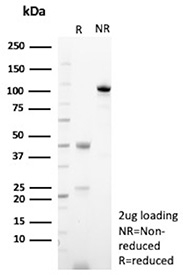 SDS-PAGE Analysis of purified recombinant CD166/ALCAM antibody (clone rMOG/07). Confirmation of Purity and Integrity of Antibody.