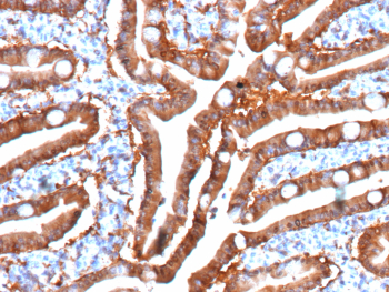 FABP2 Antibody Small Intestine IHC. Immunohistochemistry analysis of FFPE human small intestine tissue stained with FABP2 antibody clone FABP2/6344. Strong HRP-DAB brown cytoplasmic staining is observed in absorptive intestinal epithelial cells lining the villi, consistent with the known enterocyte-associated expression pattern of Intestinal fatty acid-binding protein / FABP2, a protein involved in dietary lipid absorption and intracellular fatty acid transport. Minimal background staining is present in surrounding stromal and lamina propria cells. HIER was performed using 10mM Tris with 1mM EDTA, pH 9.0.
