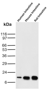 FABP2 Antibody Human, Mouse and Rat Intestine WB. Western blot analysis of human intestine, mouse intestine, and rat intestine tissue lysates using FABP2 antibody clone FABP2/6344. A distinct band is detected at approximately 15 kDa in each sample, consistent with the predicted molecular weight of Intestinal fatty acid-binding protein / FABP2 and its conserved expression in absorptive intestinal epithelial cells across species.