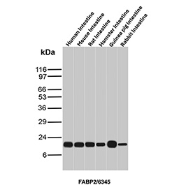 Intestinal FABP Antibody Multi-Species Intestine WB. Western blot analysis of FABP2 in intestinal tissues. Western blot analysis was performed using tissue lysates from human intestine, mouse intestine, rat intestine, hamster intestine, guinea pig intestine, and rabbit intestine probed with Intestinal FABP/Intestinal fatty acid-binding protein antibody (clone FABP2/6345). A distinct immunoreactive band is observed at the predicted molecular weight of FABP2 across all intestinal samples, consistent with conserved expression of Intestinal FABP in absorptive intestinal epithelium. Predicted molecular weight ~15 kDa.