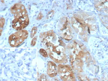 Intestinal FABP Antibody IHC. Immunohistochemistry analysis of formalin-fixed, paraffin-embedded human kidney tissue stained with Intestinal FABP/Intestinal fatty acid-binding protein antibody (clone FABP2/6345). Brown chromogenic signal indicates FABP2-positive epithelial cells, while surrounding stromal cells show minimal staining. Inset shows PBS in place of the primary antibody as a secondary-only negative control. Antigen retrieval was performed by heating tissue sections in 10mM Tris with 1mM EDTA, pH 9.0, for 45 minutes at 95oC followed by cooling at room temperature for 20 minutes.