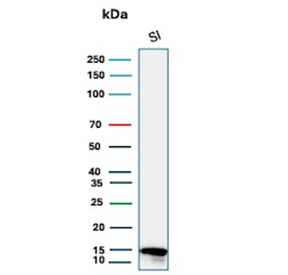 Intestinal FABP Antibody Human Intestine WB. Western blot analysis of human small intestine tissue lysate using Intestinal FABP/Intestinal fatty acid-binding protein antibody (FABP2/6345).