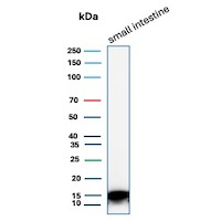 Intestinal fatty acid-binding protein Antibody Human Intestine WB. Western blot analysis of human small intestine tissue lysate using Intestinal fatty acid-binding protein antibody (clone FABP2/6936). Predicted molecular weight ~15 kDa.
