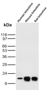 Intestinal fatty acid-binding protein Antibody Human Mouse Rat Small Intestine WB. Western blot analysis of human intestine, mouse intestine and rat intestine tissue lysates using Intestinal fatty acid-binding protein/I-FABP antibody (clone FABP2/6936). Predicted molecular weight ~15 kDa.