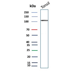 Western blot analysis of human tonsil cell lysate using SATB2/Special AT-rich sequence-binding protein 2 antibody (clone SATB2/7489). A single band is detected at approximately 100 kDa, which is slightly higher than the predicted molecular weight of SATB2 (~83 kDa), consistent with post-translational modification and known aberrant migration of chromatin-associated transcription factors.
