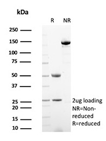 SDS-PAGE Analysis of purified SATB2/Special AT-rich sequence-binding protein 2 antibody (clone SATB2/7489). Confirmation of Purity and Integrity of Antibody.