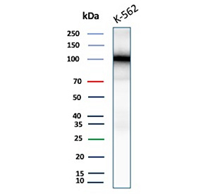 SATB2 Transcription Factor Antibody K562 Cell WB. Western blot analysis of human K562 cell lysates using recombinant SATB2 Transcription Factor antibody (clone SATB2/9432R). A single band is detected at approximately 100 kDa, which is slightly higher than the predicted molecular weight of SATB2 (~83 kDa), consistent with post-translational modification and known aberrant migration of chromatin-associated transcription factors.