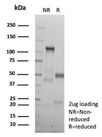 SDS-PAGE Analysis of purified recombinant GCG/Glucagon antibody (clone GCG/13090R). Confirmation of Purity and Integrity of Antibody.