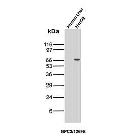 Western blot analysis of human liver tissue lysate and human HepG2 cell lysate probed with GPC3/Glypican-3 antibody (clone GPC3/12698). A clear band is detected in HepG2 cells near the predicted molecular weight of approximately 70 kDa, consistent with Glypican-3. In contrast, no detectable band is observed in normal human liver tissue under the same conditions, consistent with low or absent Glypican-3 expression in non-malignant adult liver. The observed migration pattern is consistent with reported post-translational processing and glycosylation of this glycosylphosphatidylinositol-anchored proteoglycan.