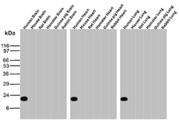 GSTP1 Antibody Brain and Heart and Lung Multi-Tissue Western Blot. Western blot analysis of GSTP1 expression across multiple species and tissues using GSTP1 antibody clone GSTP1/12956R. A consistent band at approximately 23-25 kDa is detected, supporting recognition of GSTP1 across tested samples.