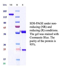 GSTP1 Antibody SDS-PAGE Integrity NR vs R. SDS-PAGE analysis of antibody integrity under non-reducing (NR) and reducing (R) conditions using GSTP1 antibody clone GSTP1/12956R. Under reducing conditions, bands corresponding to antibody heavy and light chains are observed, consistent with expected antibody structure.