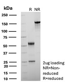 SDS-PAGE Analysis of purified recombinant APC/Adenomatous polyposis coli antibody (clone rEMM43). Confirmation of Purity and Integrity of Antibody.