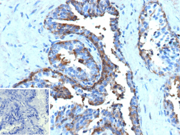 Formalin-fixed, paraffin-embedded human prostate stained with recombinant HSPB1/Heat shock protein beta 1 antibody (clone r2B4). Prostatic epithelial cells show cytoplasmic brown chromogenic staining consistent with HSPB1 expression, while surrounding stromal cells display minimal signal. Nuclei are counterstained blue. Inset shows a PBS-only negative control processed without primary antibody, demonstrating minimal non-specific background staining.