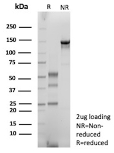 SDS-PAGE Analysis purified recombinant IGHG1/Immunoglobulin heavy constant gamma 1 antibody (clone rIGHG1/13035). Confirmation of Purity and Integrity of Antibody.