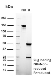 SDS-PAGE Analysis of purified recombinant mouse AR/Androgen receptor antibody (clone r2F12). Confirmation of Purity and Integrity of Antibody.