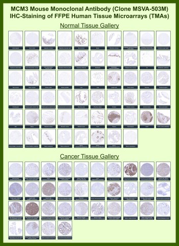 MCM3 Antibody for IHC Tissue Microarray (TMA). Immunohistochemistry analysis of Minichromosome maintenance complex component 3 MCM3 in formalin-fixed paraffin-embedded human normal and cancer tissue microarrays using recombinant mouse monoclonal MCM3 antibody clone MSVA-503M. Tissue microarray (TMA) staining with HRP-DAB brown chromogen demonstrates distinct nuclear localization in proliferating cell populations, consistent with the role of MCM3 as a DNA replication licensing factor regulating S-phase entry. In normal tissue microarrays, nuclear staining is enriched in proliferative compartments such as epithelial basal layers, intestinal crypts, and lymphoid germinal centers, while quiescent and terminally differentiated cells show minimal to absent signal. Within tumor tissue microarrays, strong and widespread nuclear positivity is observed across a broad range of malignancies, reflecting elevated proliferative activity in tumor cells. Evaluation across large TMA panels enables direct comparison of MCM3 expression across diverse tissue types under standardized conditions. The observed staining patterns align with reported MCM3 expression profiles in the Human Protein Atlas and support its use as a robust proliferation marker.