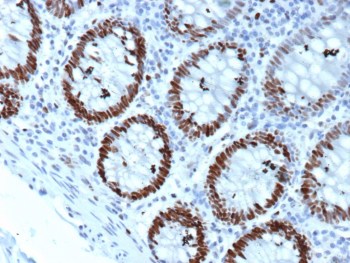 Immunohistochemistry staining of formalin-fixed, paraffin-embedded human colon with MCM4/DNA replication licensing factor 4 antibody (clone MCM4/3041). Strong nuclear brown staining is observed in proliferating epithelial cells lining the colonic glands, consistent with MCM4 as a replication licensing factor and proliferation-associated marker, while surrounding stromal cells show minimal to weak labeling. Heat-induced epitope retrieval was performed by boiling tissue sections in pH 9, 10mM Tris with 1mM EDTA for 20 min followed by cooling prior to staining.