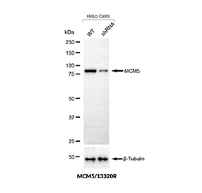 MCM5 Antibody Knockdown Validation HeLa. Knockdown validation of MCM5 expression in human HeLa cells using MCM5 antibody clone MCM5/13320R. Lane 1: wild-type cells, Lane 2: MCM5 shRNA knockdown cells. A marked reduction in band intensity is observed in knockdown samples compared to wild-type controls, confirming specific detection of endogenous MCM5. Beta-Tubulin is used as a loading control.