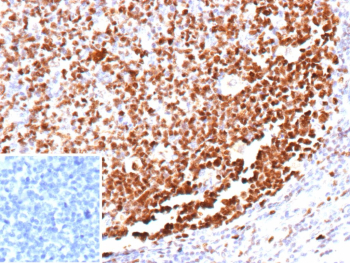 MCM5 Antibody Tonsil Germinal Center IHC. Immunohistochemistry analysis of MCM5 expression in FFPE human tonsil tissue using MCM5 antibody clone MCM5/13320R. Strong HRP-DAB brown nuclear staining highlights proliferating lymphoid cells within germinal centers, while surrounding non-proliferating lymphocytes show reduced or absent staining. A negative control inset using PBS in place of primary antibody shows no specific staining, confirming minimal non-specific background. Heat induced epitope retrieval was performed by boiling tissue sections in 10 mM Tris with 1 mM EDTA, pH 9, for 45 minutes followed by cooling prior to staining.
